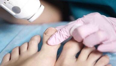 Bacaklardaki mantarın donanım tedavisi