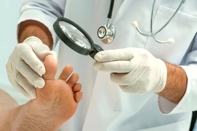 ayak tırnaklarını inceleyen dermatolog