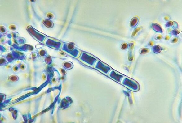 Mantar Trichophyton rubrum mikroskop altında