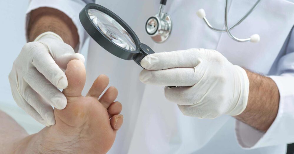 doktor ayaklarda mantar olup olmadığını inceliyor